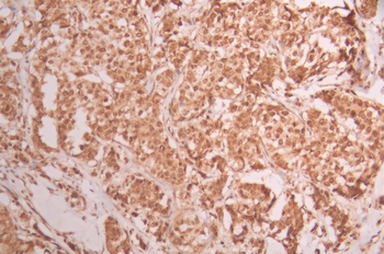 CELF1 Antibody
