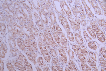 CELF1 Antibody