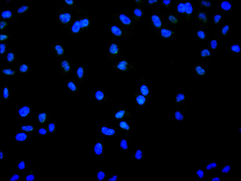 CELF1 Antibody