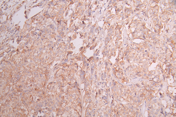 ECM1 Antibody