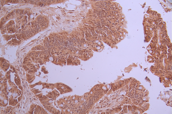EHMT2 Antibody