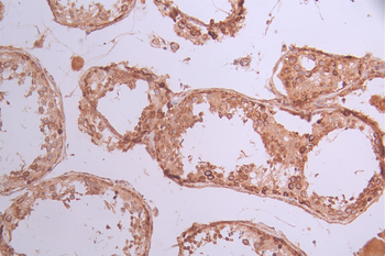 BCL2L14 Antibody