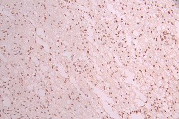 TARBP2 Antibody
