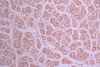 PDHA1 Antibody