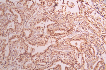 PML Antibody