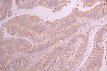 ABCE1 Antibody