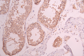 ABCE1 Antibody