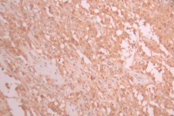 KLC1 Antibody