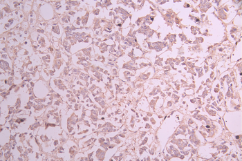 LGALS8 Antibody