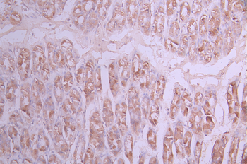 LGALS8 Antibody