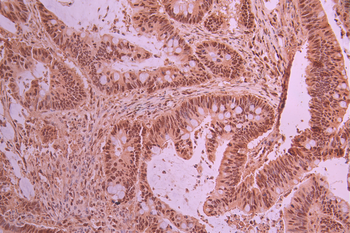 PRMT1 Antibody