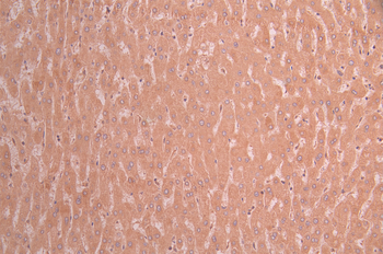 BID Antibody