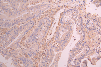 ATG7 Antibody