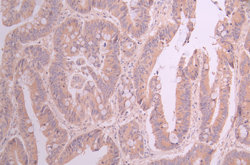 BCL2L11 Antibody