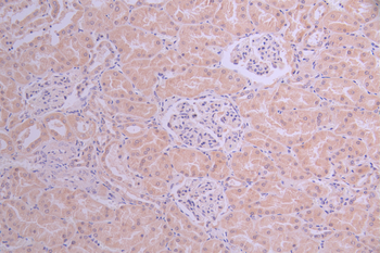 BCL2L11 Antibody