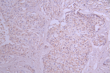 GRN Antibody