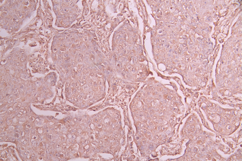 BAD Antibody