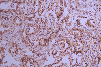 MCM2 Antibody