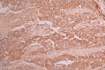 EIF1AX Antibody