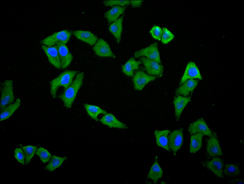 PSMC5 Antibody