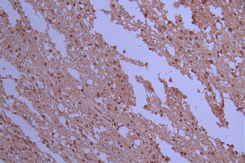 PPP2R5D Antibody