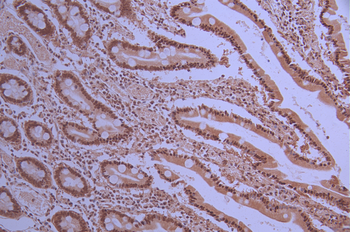 PPP2R5D Antibody