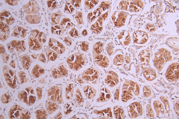 SEPTIN8 Antibody