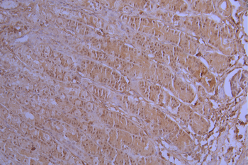 PRPF4 Antibody