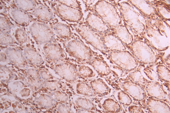 PRPF4 Antibody