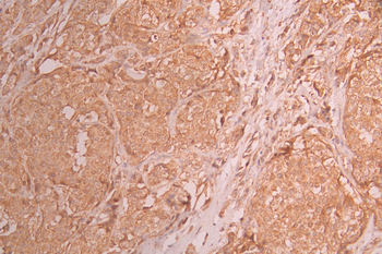 ACTR1B Antibody