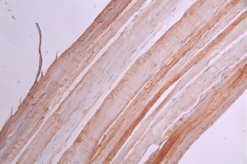 ACTR1B Antibody