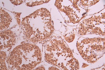RANBP3 Antibody