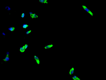 EEF1A1 Antibody
