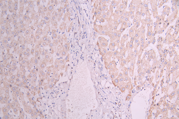 NDUFB8 Antibody