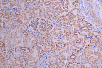NDUFB8 Antibody