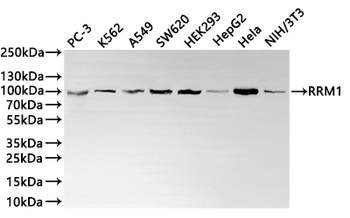 RRM1 Antibody