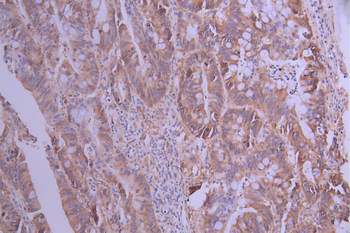 RRM1 Antibody