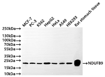 NDUFB9 Antibody