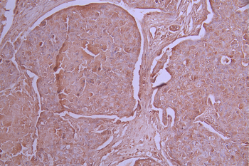 NDUFB9 Antibody