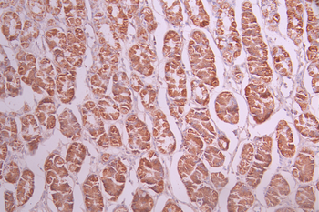 NDUFB9 Antibody