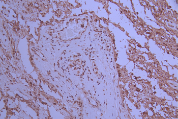 XRCC6 Antibody