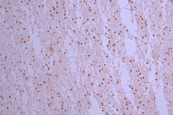 PIAS1/PIAS2 Antibody