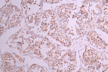 PIAS1/PIAS2 Antibody