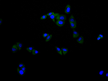MAP3K2 Antibody