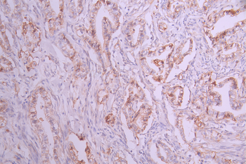 ITGA2 Antibody