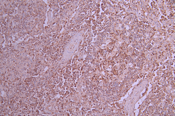 MCM6 Antibody