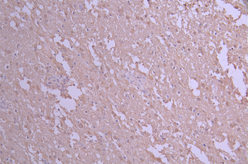 MAP1LC3A Antibody