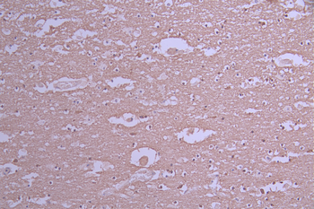 MAP1LC3A Antibody