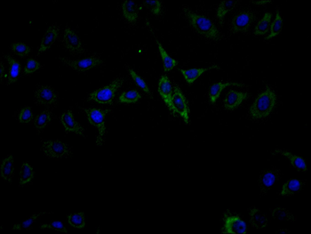 SMYD3 Antibody