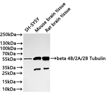 TUBB4B/TUBB2A/TUBB2B Antibody